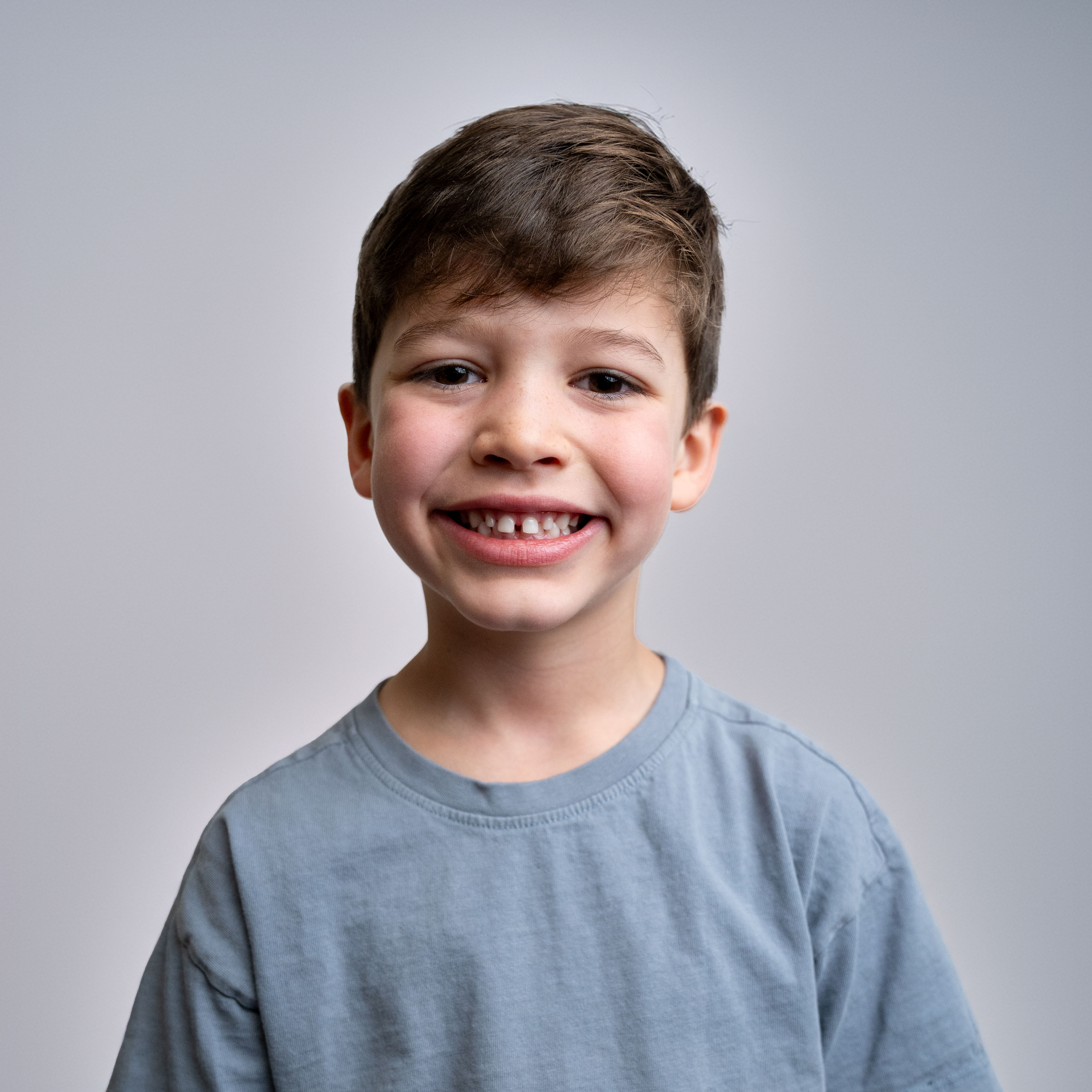 KI Vergleich Links Nachher